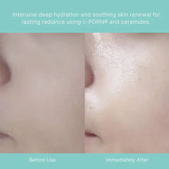 REJURAN Turnover Mask (Prev. Healing Mask) 40ml X 5ea