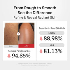 medicube Hypochlorous Acid Body Peel Shot 280ml