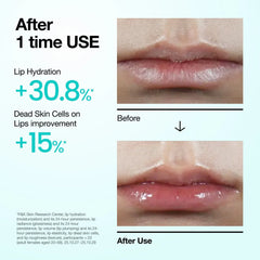 Anua PDRN Lip Serum 10ml+10ml [DUO SET]
